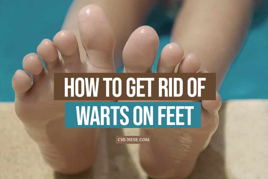How to get rid of warts on feet