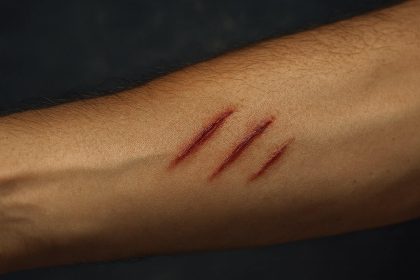demonic scratches