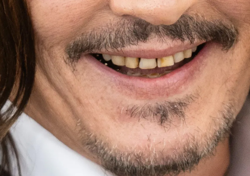 5 Theories Behind Johnny Depps Bad Teeth