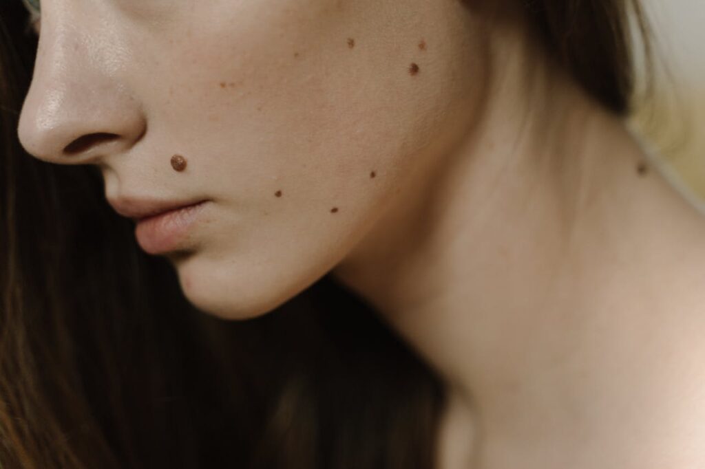 three moles in a triangle spiritual meaning